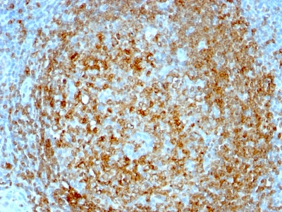 Monoclonal Antibody to CD74 (B-Cell Marker)(Clone : CLIP/813)