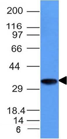 Monoclonal Antibody to CD74 (B-Cell Marker)(Clone : CLIP/1133)