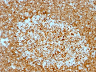 Monoclonal Antibody to CD74 (B-Cell Marker)(LN-2 + CLIP/813)