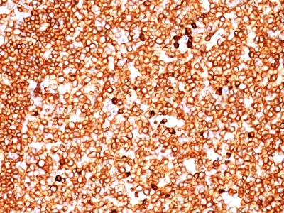 Monoclonal Antibody to CD79a (B-Cell Marker)(Clone : SPM549)