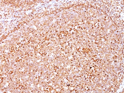 Monoclonal Antibody to CD79a (B-Cell Marker)(Clone : SPM550)