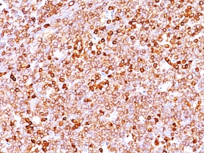 Monoclonal Antibody to CD79a (B Cell Marker)(JCB117 + HM47/A9)