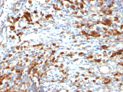 Monoclonal Antibody to CD79a (B-Cell Marker)(Clone : IGA/764)