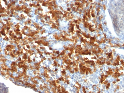 Monoclonal Antibody to CD79a (B-Cell Marker)(Clone : IGA/515)