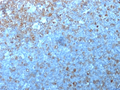 Monoclonal Antibody to Cdk1 / p34cdc2(Clone : POH-1; same as cdc2.1)