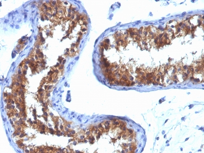 Monoclonal Antibody to Major Vault Protein (MVP)(Clone : 1032)