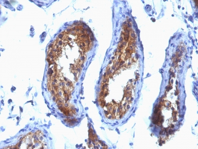 Monoclonal Antibody to Major Vault Protein (MVP)(Clone : SPM280)