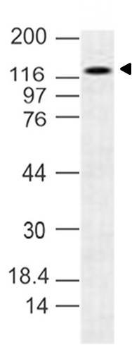 Mouse Monoclonal Antibody To N-Cadherin  (Clone: 13A9)