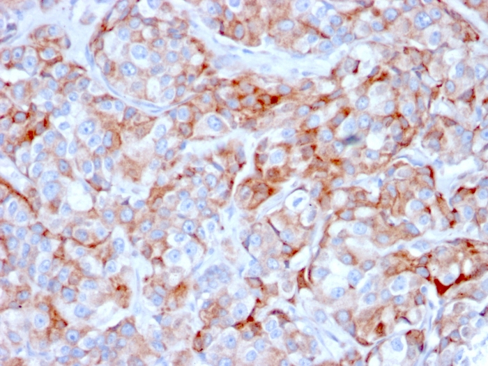 Monoclonal Antibody to CD269 / TNFRSF17 / BCMA (B-Cell Maturation Protein) (MHC II)(Clone : BCMA/2366)