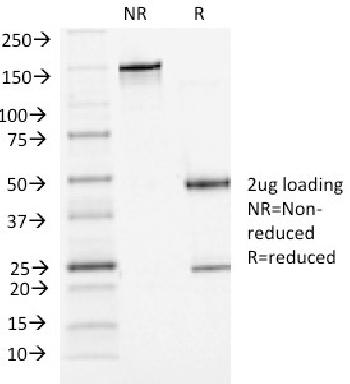 Anti-P-Cadherin (CDH3) Monoclonal Antibody(Clone: 6A9)