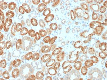 Anti-Occludin (OCLN) (Tight Junctions Marker) Monoclonal Antibody (Clone:OCLN/2183)