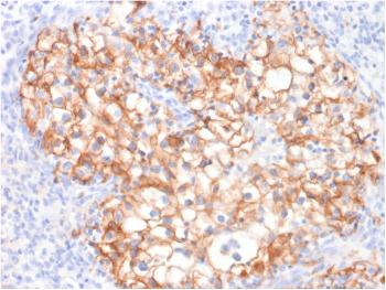 Anti-Ksp-Cadherin / CDH16 (Renal Cell Marker) Monoclonal Antibody (Clone: CDH16/2125)