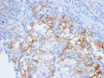 Anti-Ksp-Cadherin / CDH16 (Renal Cell Marker) Monoclonal Antibody (Clone: CDH16/2448)