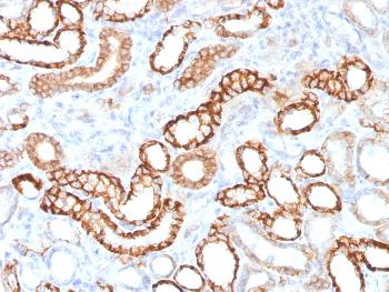 Anti-Ksp-Cadherin (Kidney-Specific Cadherin) / CDH16 Monoclonal Antibody (Clone: CDH16/1532R)