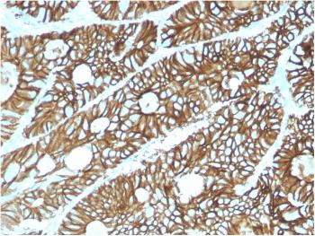 Anti-Cadherin 17 / LI Cadherin (Liver-Intestine Marker) Monoclonal Antibody (Clone: CDH17/2615)