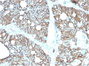 Anti-Cadherin 17 / LI Cadherin (Liver-Intestine Marker) Monoclonal Antibody (Clone: CDH17/2616)