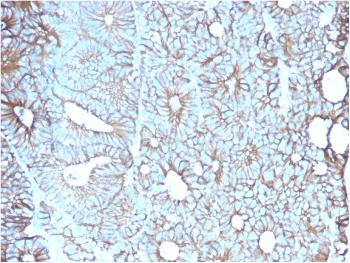 Anti-Cadherin 17 / LI Cadherin (Liver-Intestine Marker) Monoclonal Antibody (Clone: CDH17/2617)