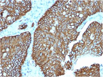 Anti-Cadherin 17 / LI Cadherin (Liver-Intestine Marker) Monoclonal Antibody (Clone: CDH17/2618)