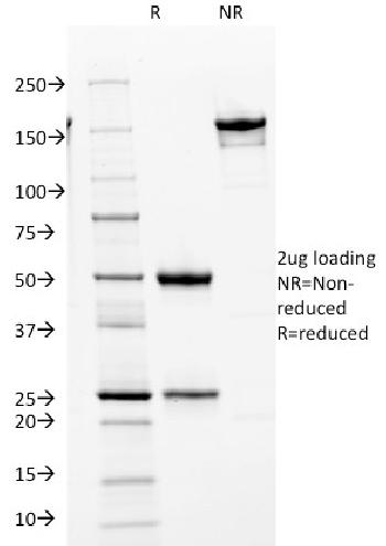 Anti-Cdk2 / p34cdc2 Serine-Threonine Kinase Monoclonal Antibody (Clone: AN4.3)