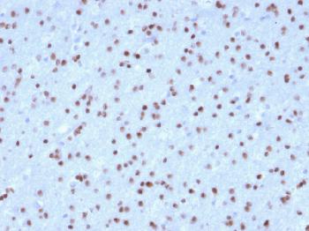 Anti-OLIG2 (Marker of Glial Brain Tumors) Monoclonal Antibody (Clone: OLIG2/2400)