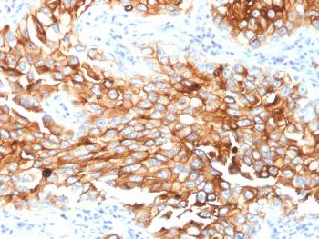 Anti-Mesothelin (Mesothelial Marker) Monoclonal Antibody (Clone: MSLN/2131)