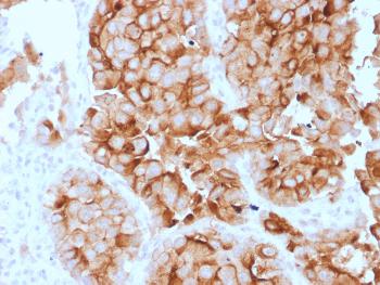 Anti-Mesothelin (Mesothelial Marker) Monoclonal Antibody (Clone: SPM143)