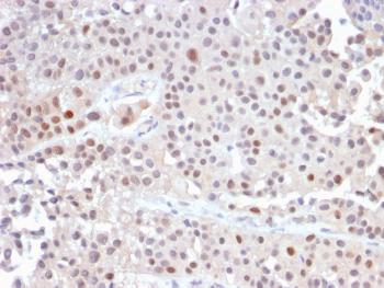 Anti-p21WAF1 (Tumor Suppressor Protein) Monoclonal Antibody (Clone: CIP1/2489R)