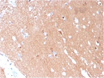 Anti-Tubulin beta 3 / TUBB3 (Neuronal & Stem Cell Marker) Monoclonal Antibody (Clone: TUBB3/3731)