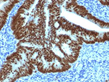 Anti-CDX2 / Caudal Type Homeobox 2 (GI Epithelial Marker) Monoclonal Antibody (Clone: CDX2/1690)