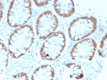 Anti-CDX2 / Caudal Type Homeobox 2 (GI Epithelial Marker) Monoclonal Antibody (Clone: rCDX2/1690)