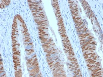 Anti-CDX2 (GI Epithelial Marker) Monoclonal Antibody (Clone: CDX2/2951R)