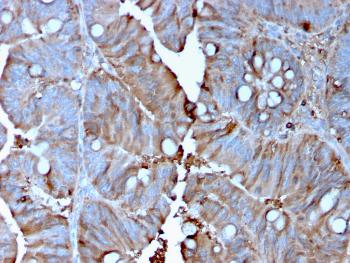 Anti-MerTK (Innate Immune Checkpoint) Monoclonal Antibody (Clone: MERTK/3015)