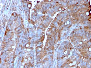 Anti-MerTK (Innate Immune Checkpoint) Monoclonal Antibody (Clone: MERTK/3022)