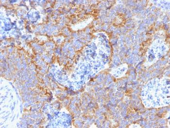 Anti-Carcinoembryonic Antigen (CEA) / CD66 Monoclonal Antibody (Clone: C66/1291)