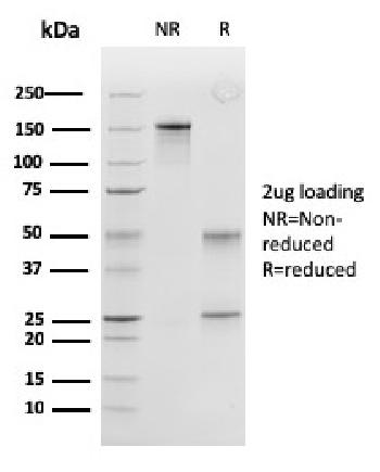 Anti-Peroxiredoxin 4 (Prognostic Marker for Lung SqCC) Monoclonal Antibody (Clone: CPTC-PRDX4-2)