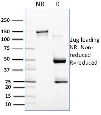 Anti-CD257 / BAFF / TNFSF13B Monoclonal Antibody (Clone: C257/1638)