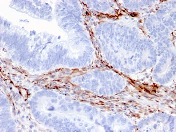 Anti-Nestin (Cancer Stem Cell Marker) Monoclonal Antibody (Clone: NES/2911)