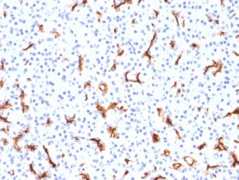 Anti-CFTR (Cystic Fibrosis Transmembrane Conductance Regulator) Monoclonal Antibody (Clone: CFTR/1785)