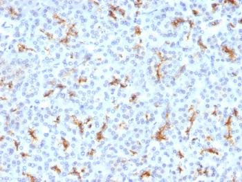 Anti-CFTR (Cystic Fibrosis Transmembrane Conductance Regulator) Monoclonal Antibody (Clone: CFTR/1342)