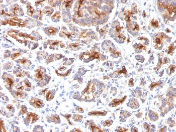 Anti-CFTR (Cystic Fibrosis Transmembrane Conductance Regulator) Monoclonal Antibody (Clone: SPM176)