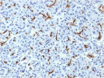 Anti-CFTR (Cystic Fibrosis Transmembrane Conductance Regulator) Monoclonal Antibody (Clone: CFTR/1643)