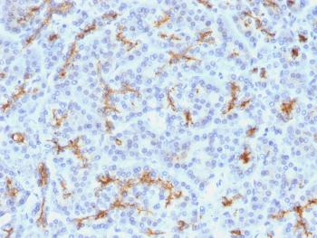 Anti-CFTR (Cystic Fibrosis Transmembrane Conductance Regulator) Monoclonal Antibody (Clone: M3A7)