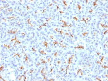 Anti-CFTR (Cystic Fibrosis Transmembrane Conductance Regulator) Polyclonal Antibody