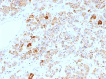 Anti-LH, alpha (Luteinizing Hormone, alpha) Monoclonal Antibody (Clone: LHa/756)