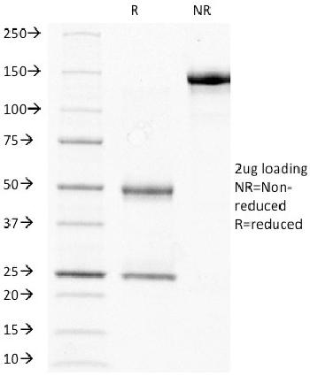 Anti-HCG-beta (Pregnancy & Choriocarcinoma Marker) Monoclonal Antibody (Clone: HCGb/211)