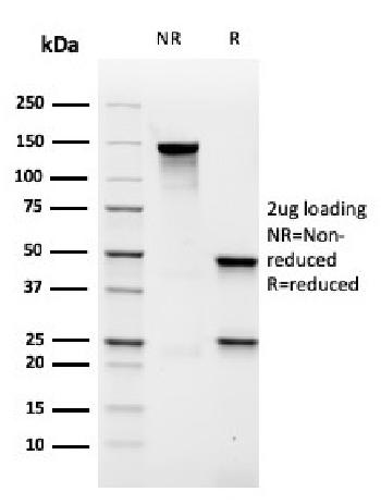 Anti-MALT1 (MALT-Lymphoma Marker) Monoclonal Antibody (Clone: rMT1/410)