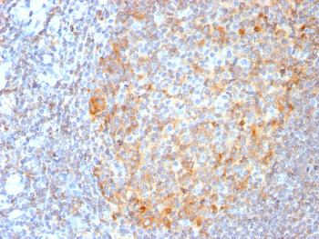 Anti-MALT1 (MALT-Lymphoma Marker) Monoclonal Antibody (Clone: MT1/3159R)