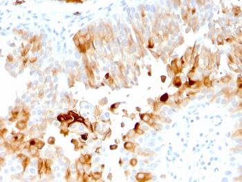 Anti-Uroplakin 1A (Urothelial Differentiation Marker) Monoclonal Antibody (Clone: UPK1A/2921)