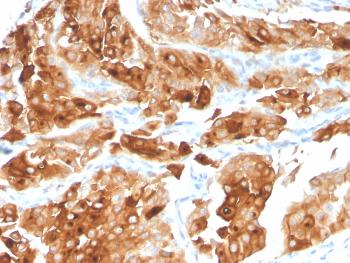 Anti-Uroplakin 1A (Urothelial Differentiation Marker) Monoclonal Antibody (Clone: UPK1A/2922)