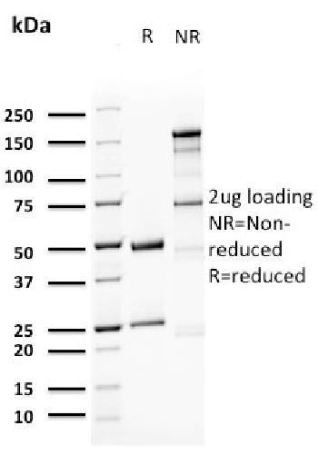 Anti-Uroplakin 1A (Urothelial Differentiation Marker) Monoclonal Antibody (Clone: UPK1A/2923)